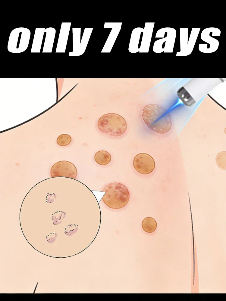 Бесплатная доставка по специальным предложениям для успокаивающих проблем на коже. 2025. Портативный комплект унисекс с синей световой ручкой.
Бесплатная доставка по специальным предложениям для успокаивающих проблем на коже. 2025. Портативный комплект унисекс с синей световой ручкой.