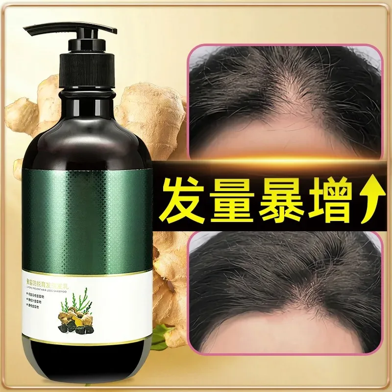 Ginger Anti Shedding Shampoo for Hair Care Oil Control and Dense Black Hair Polygonum Multiflorum Shampoo Шампунь Для Волос
Ginger Anti Shedding Shampoo for Hair Care Oil Control and Dense Black Hair Polygonum Multiflorum Shampoo Шампунь Для Волос
