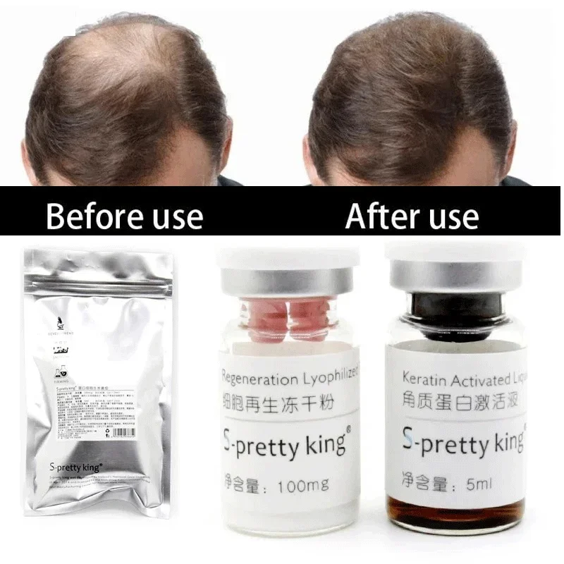 New 2024 Hair Growth Serum Product Fast Growing Meso Solution Beauty Hair Care Prevent Hair Loss Treatment For Men Women
New 2024 Hair Growth Serum Product Fast Growing Meso Solution Beauty Hair Care Prevent Hair Loss Treatment For Men Women