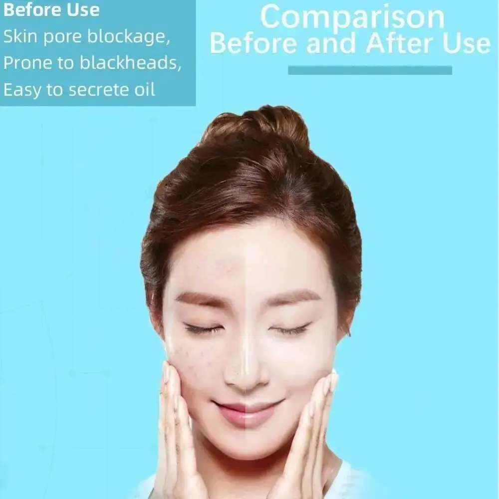 Electric Tool Blackhead Remover Water Cycle Vacuum Suction Acne Cleaner USB Rechargeable Black Point Removal
Electric Tool Blackhead Remover Water Cycle Vacuum Suction Acne Cleaner USB Rechargeable Black Point Removal