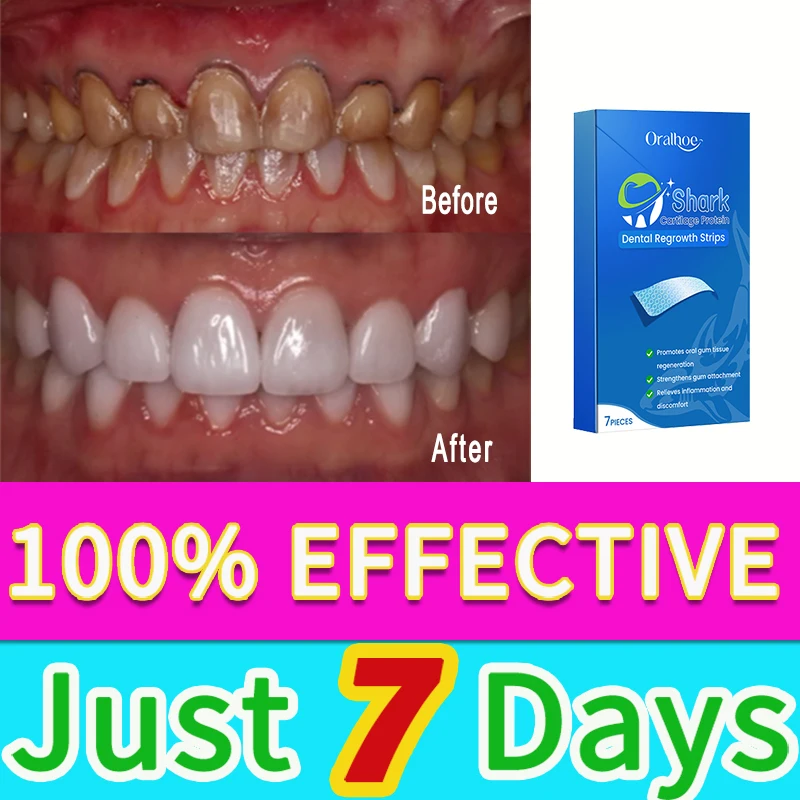 Removing Tartar Whitening Teeth Removing Bad Breath Preventing Dental Inflammation And Applying Dental Patches
Removing Tartar Whitening Teeth Removing Bad Breath Preventing Dental Inflammation And Applying Dental Patches