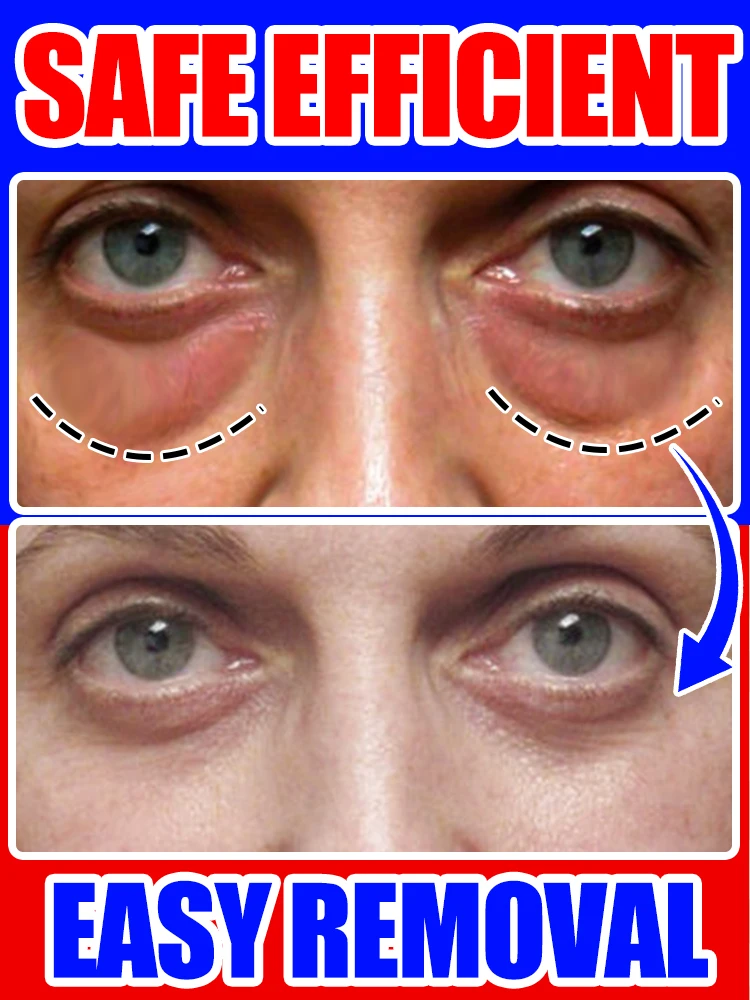 over 90% buyer choose Eye Cream Collagen Fade Fine Lines Wrinkle Lightening Dark Circles Firming Eye Bags Puffiness Moisturizing
over 90% buyer choose Eye Cream Collagen Fade Fine Lines Wrinkle Lightening Dark Circles Firming Eye Bags Puffiness Moisturizing