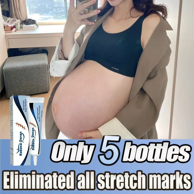 Stretch Marks Permanent Removal Cream Eliminate Body Belly Stretch Marks Swelling Marks Remove Skin Cracks Repair Firming Care
Stretch Marks Permanent Removal Cream Eliminate Body Belly Stretch Marks Swelling Marks Remove Skin Cracks Repair Firming Care