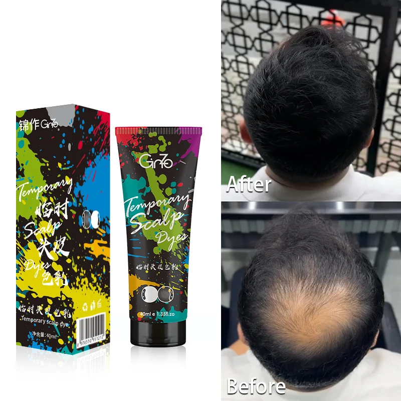 Bald Dye Cream Root Touch Up Hair Color for Gray Coverage Bald Spot Concealing Hair Cream for Women&Men Hair Thinning Solution
Bald Dye Cream Root Touch Up Hair Color for Gray Coverage Bald Spot Concealing Hair Cream for Women&Men Hair Thinning Solution