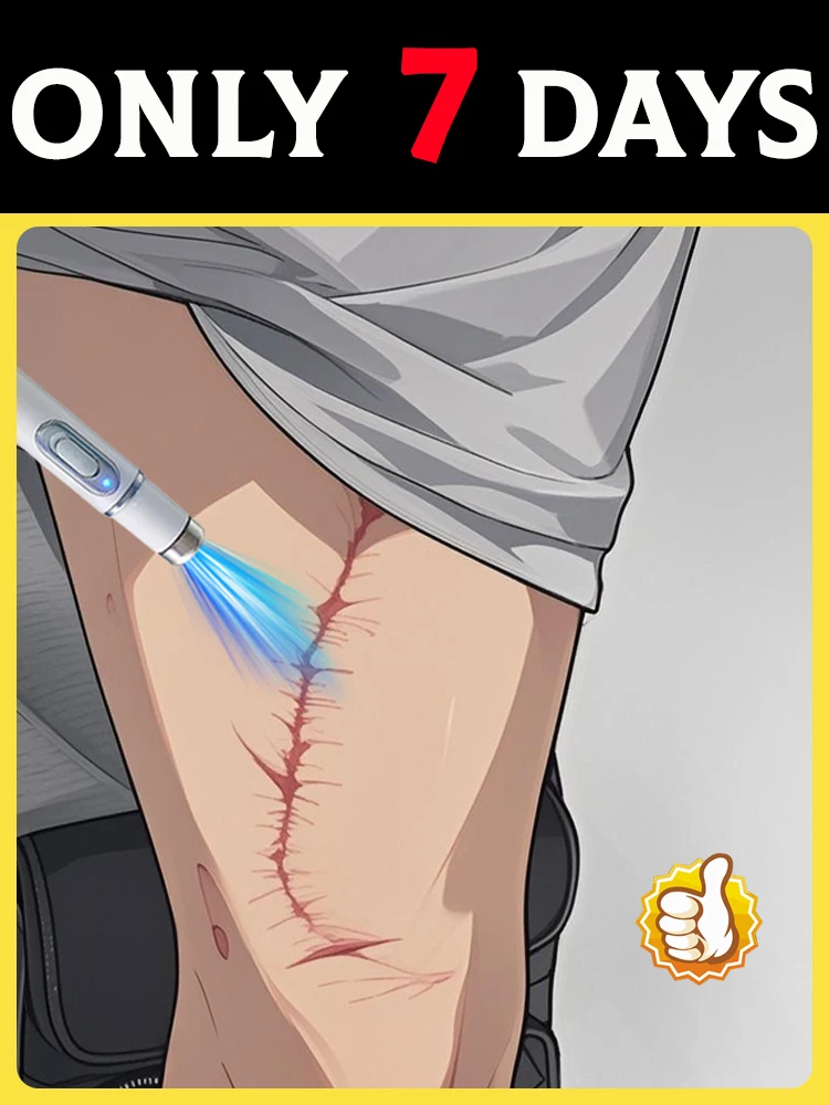 2nd ᵍᵉⁿᵉʳᵃᵗⁱᵒⁿ ᵘᵖᵍʳᵃᵈᵉᵈ scar ⸴ ʳᵉpᵃⁱʳ scar ʳᵒoᵗ ⸴ ᑫᵘⁱᶜᵏˡʸ
2nd ᵍᵉⁿᵉʳᵃᵗⁱᵒⁿ ᵘᵖᵍʳᵃᵈᵉᵈ scar ⸴ ʳᵉpᵃⁱʳ scar ʳᵒoᵗ ⸴ ᑫᵘⁱᶜᵏˡʸ