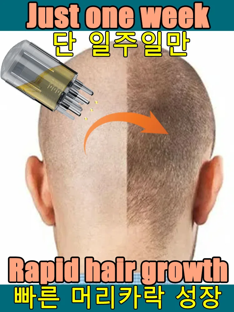 100% revive hair, strong penetration, activate hair roots, more hair, say goodbye to baldness, thick hair
100% revive hair, strong penetration, activate hair roots, more hair, say goodbye to baldness, thick hair