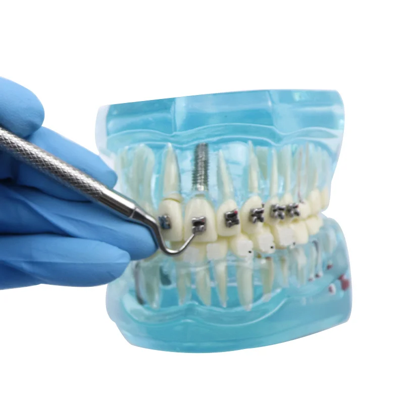 Инструмент для открывания самолигирующих брекетов, 1 шт., ортодонтический инструмент для открывания брекетов, пассивный открыватель самолигирующих брекетов, нержавеющая сталь
Инструмент для открывания самолигирующих брекетов, 1 шт., ортодонтический инструмент для открывания брекетов, пассивный открыватель самолигирующих брекетов, нержавеющая сталь