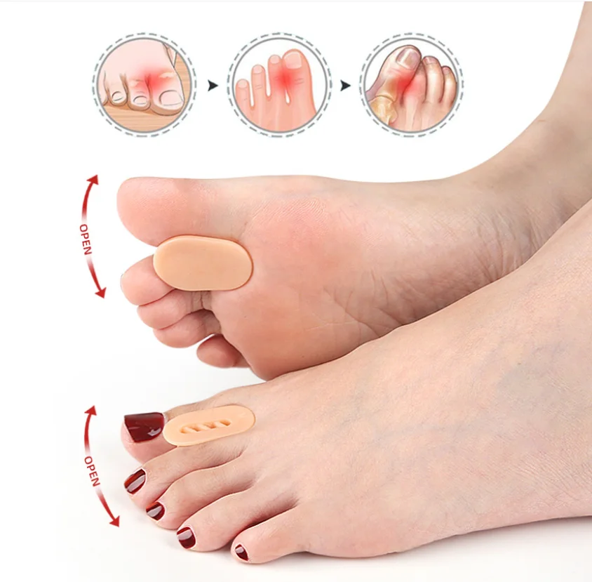 1/10Pairs Toe Spacers Separators Bunion Corrector Gel Finger Protector for Straightening Overlapping Toes for Men and Women
1/10Pairs Toe Spacers Separators Bunion Corrector Gel Finger Protector for Straightening Overlapping Toes for Men and Women