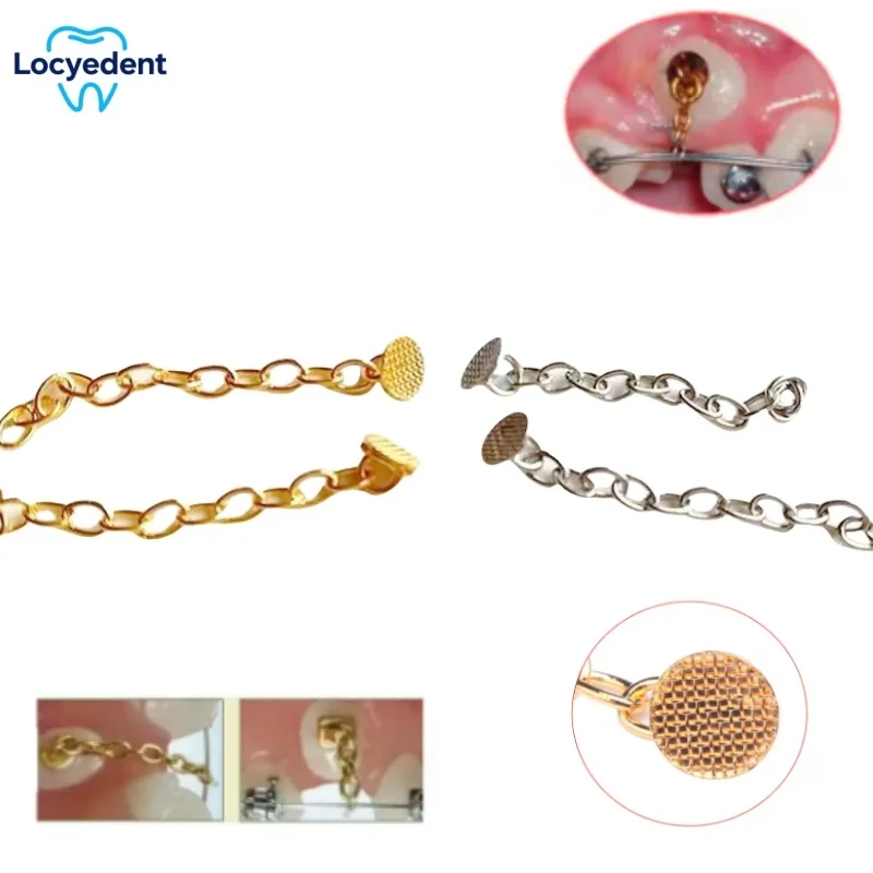 4pcs/Pack Dental Orthodontics Lingual Traction Button Chain Golden Round Acessorios Materials
4pcs/Pack Dental Orthodontics Lingual Traction Button Chain Golden Round Acessorios Materials