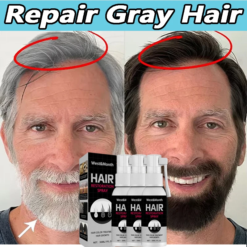Advanced Gray White Hair Care Essence Spray Natural Color Covers White Hair To Black Repair Hair Loss Restore Healthy Hair Care
Advanced Gray White Hair Care Essence Spray Natural Color Covers White Hair To Black Repair Hair Loss Restore Healthy Hair Care