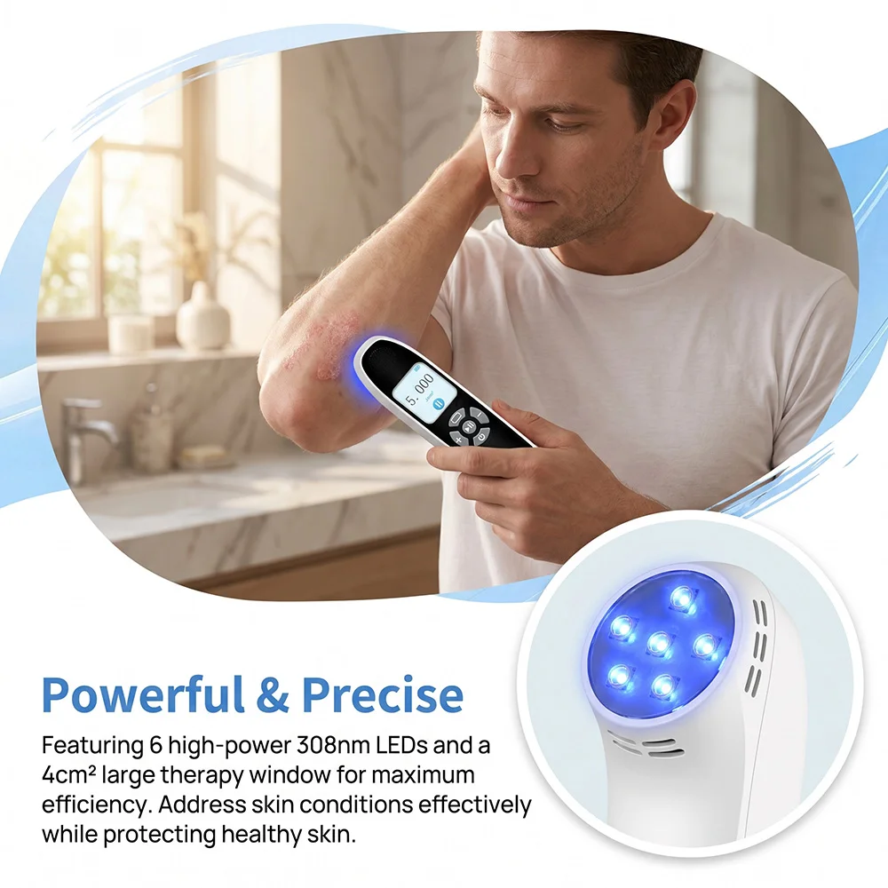 Professional 308nm UVB Light Therapy Lamp Handheld for Vitiligo Psoriasis Treatment Targeted Small Area Skin Care Home Use
Professional 308nm UVB Light Therapy Lamp Handheld for Vitiligo Psoriasis Treatment Targeted Small Area Skin Care Home Use