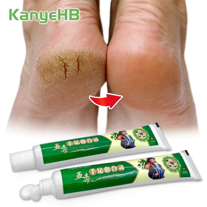 2pcs Foot Chap Repair Cream Hand Foot Moisturizing Cream Plant Essence Skin Cream Moisturize Skin Relief Wrinkles Dry Itch A1604
2pcs Foot Chap Repair Cream Hand Foot Moisturizing Cream Plant Essence Skin Cream Moisturize Skin Relief Wrinkles Dry Itch A1604