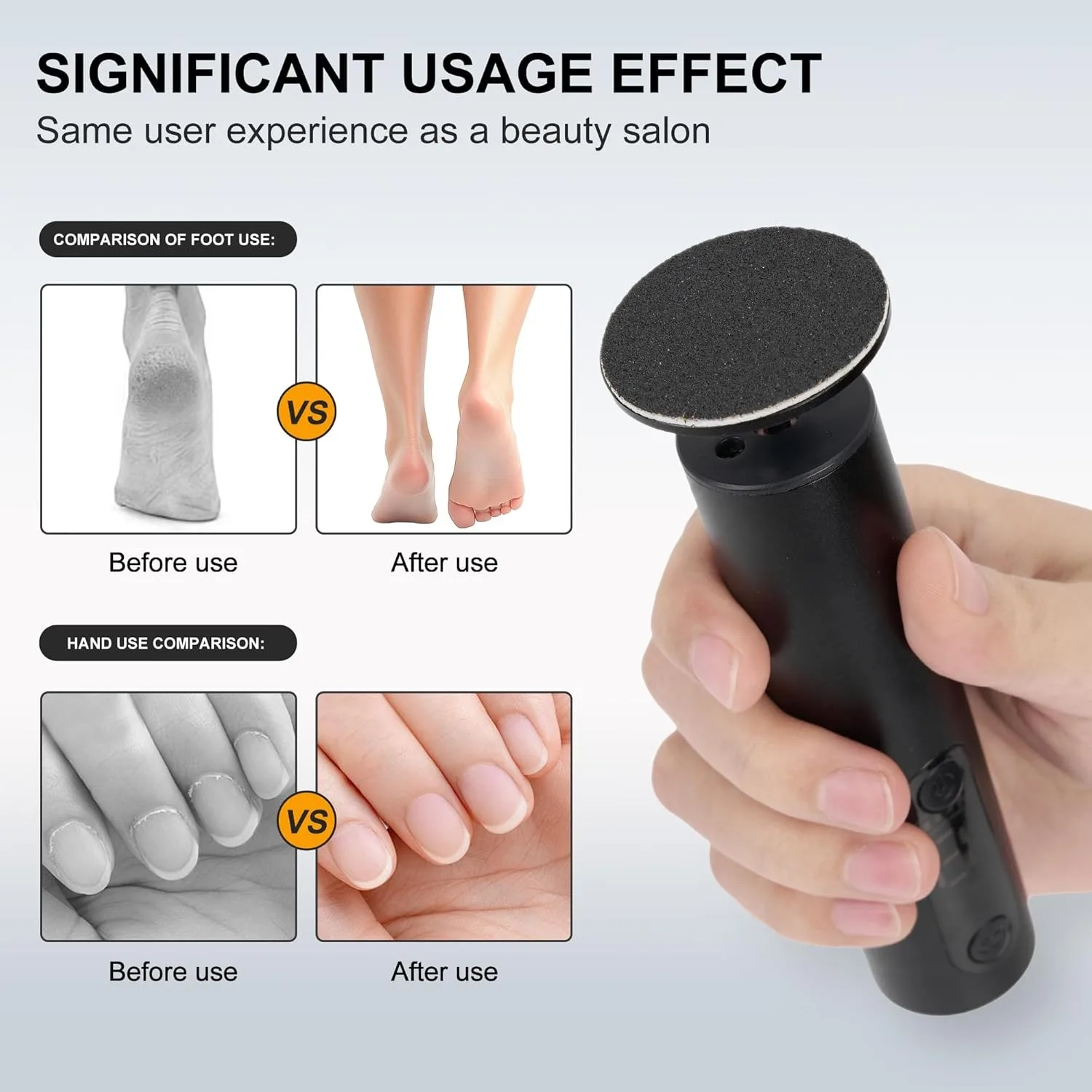 Electric Foot Callus Remover with Adjustable Speed, Foot File Heel Grinder Sander for Men Women, Dry
Electric Foot Callus Remover with Adjustable Speed, Foot File Heel Grinder Sander for Men Women, Dry
