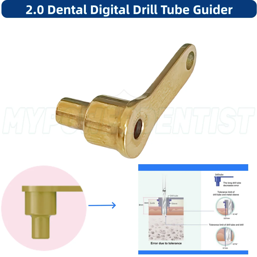Dental Digital Drill Tube Golden Guider for 2.0 Drills Dgs Fits Dionavi 5.3/3.0 Guide Sleeves
Dental Digital Drill Tube Golden Guider for 2.0 Drills Dgs Fits Dionavi 5.3/3.0 Guide Sleeves