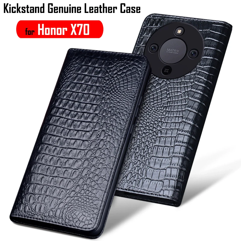 Genuine Leather Flip Funda for Honor 70 Case for Honor 70 Case wake up Sleeping Cover Fashion Kickstand Holder Funda
Genuine Leather Flip Funda for Honor 70 Case for Honor 70 Case wake up Sleeping Cover Fashion Kickstand Holder Funda