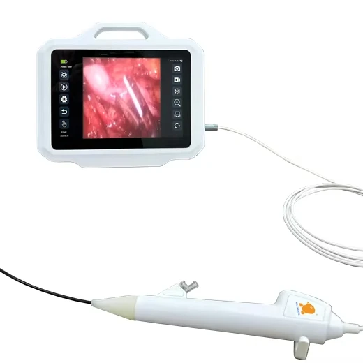 Urology Equipment Ureteroscope for Hospital
Urology Equipment Ureteroscope for Hospital