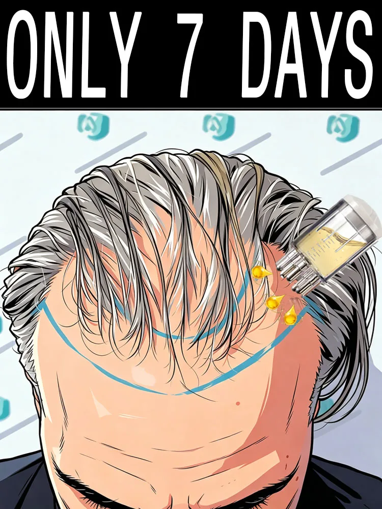 Sᴀʏ ɢᴏᴏᴅʙʏᴇ ᴛᴏ ʙᴀʟᴅɴᴇss! Repairs Hair Roots
Sᴀʏ ɢᴏᴏᴅʙʏᴇ ᴛᴏ ʙᴀʟᴅɴᴇss! Repairs Hair Roots