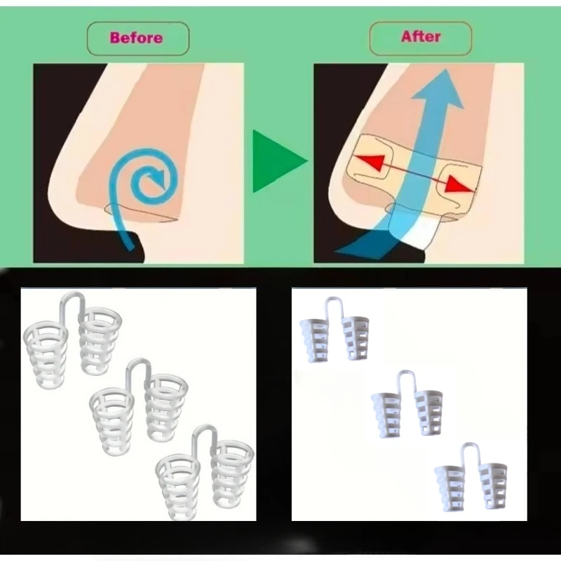 Household No Battery Nose Expander - Anti-Snoring and Sleep Apnea Nose Clip, mouth tape for sleeping mouth sleep tape
Household No Battery Nose Expander - Anti-Snoring and Sleep Apnea Nose Clip, mouth tape for sleeping mouth sleep tape