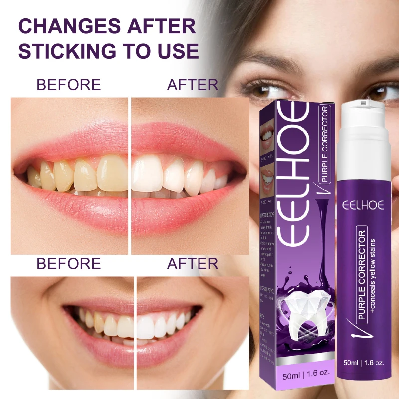 V34 Purple Colour Corrector Teeth Whitening Toothpaste Brightening Reduce Yellowing Fresh Oral Breath Cleaning Tooth Care 50ml
V34 Purple Colour Corrector Teeth Whitening Toothpaste Brightening Reduce Yellowing Fresh Oral Breath Cleaning Tooth Care 50ml