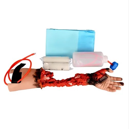 Realistic Partial Arm Amputation Wound Model Medical Manikin for Medical School and Nursing Wearable Tissue Simulation
Realistic Partial Arm Amputation Wound Model Medical Manikin for Medical School and Nursing Wearable Tissue Simulation