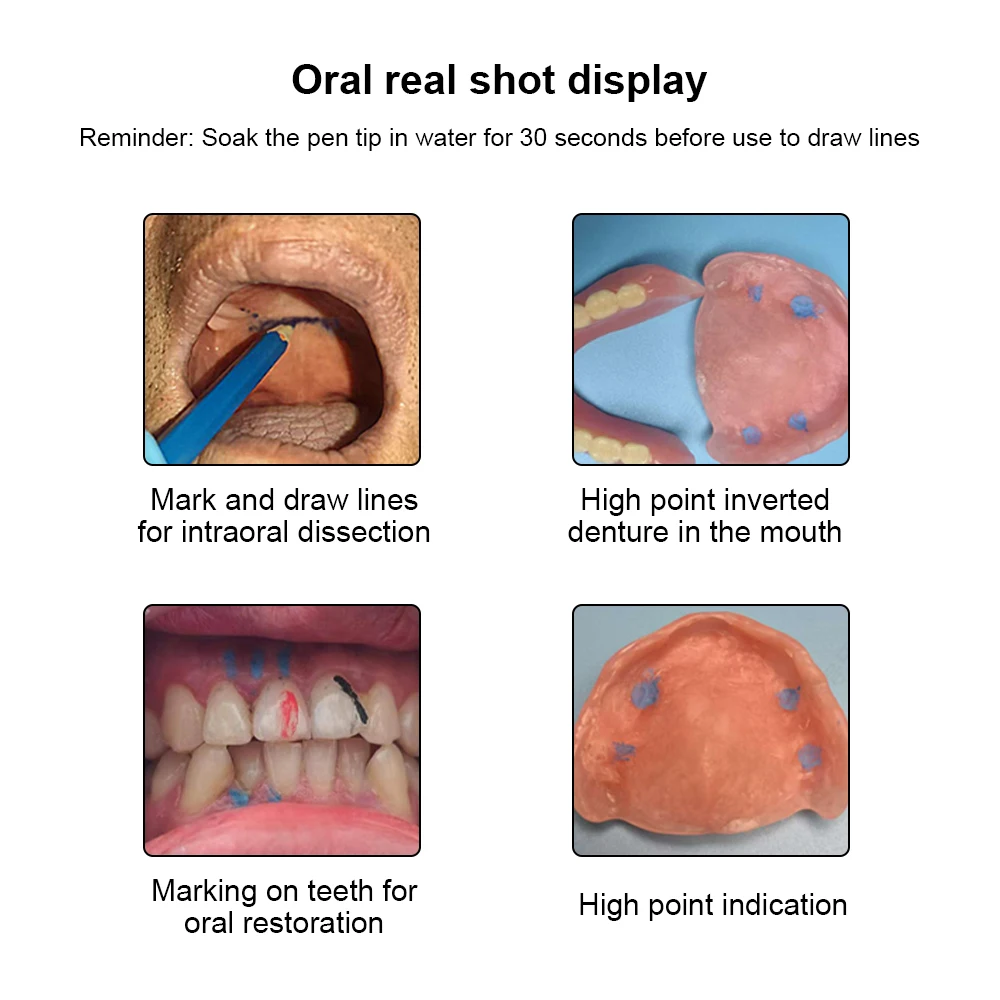 1Pcs Dental Oral Marker Pen Wood Intraoral Marker Red/Blue/Black Sterilizable Denture False Teeth Repair Sign Line Drawing Pen
1Pcs Dental Oral Marker Pen Wood Intraoral Marker Red/Blue/Black Sterilizable Denture False Teeth Repair Sign Line Drawing Pen