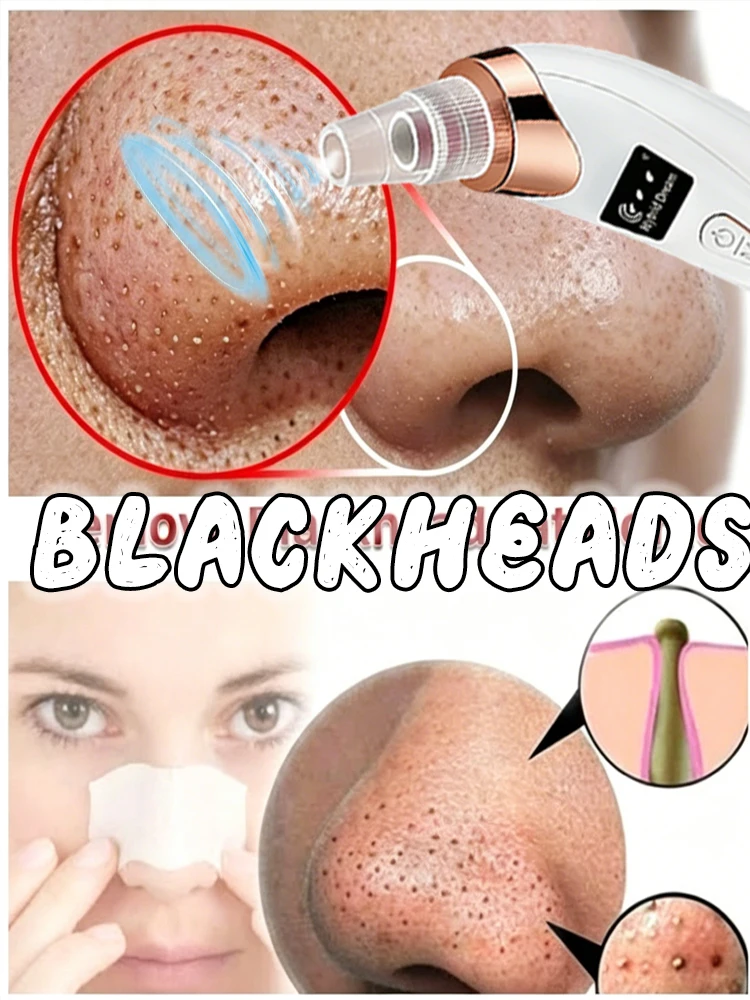 Blackhead Vacuum Suction Device, Pore Cleansing Beauty Instrument, Face Blackhead Remover Tool for Deep Pore Cleaning
Blackhead Vacuum Suction Device, Pore Cleansing Beauty Instrument, Face Blackhead Remover Tool for Deep Pore Cleaning
