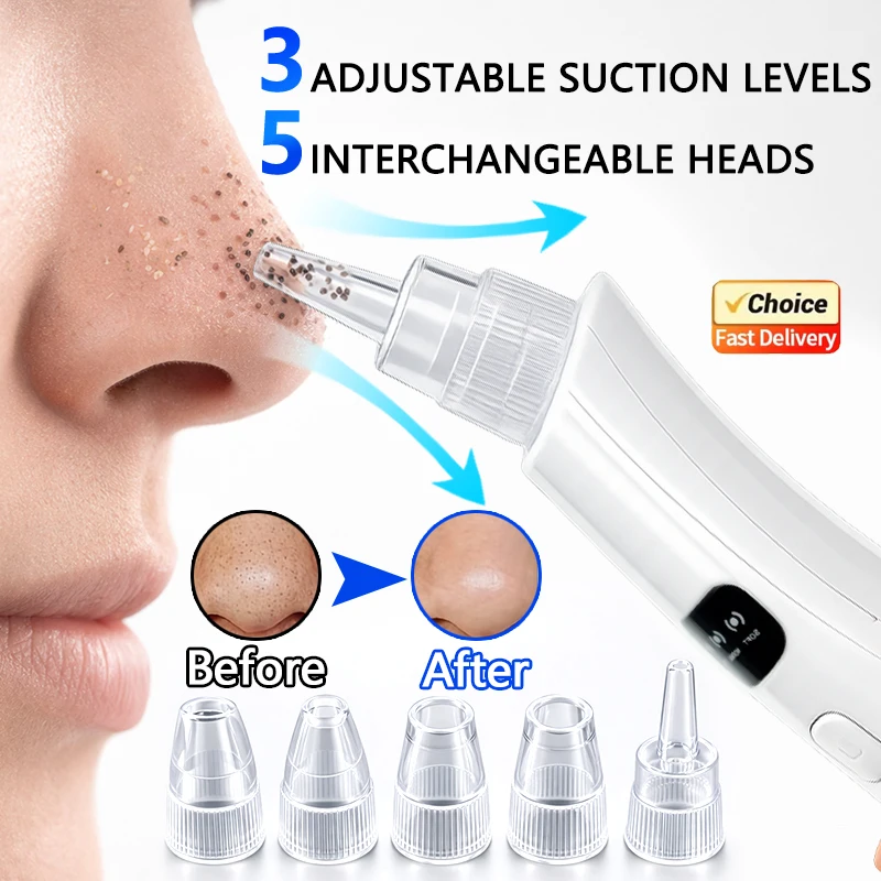 2026 New 3 Suction Mode Face Cleansing Beauty Machine Dead Skin Remover Face Vacuum Blackhead Removal Skin Care Tool
2026 New 3 Suction Mode Face Cleansing Beauty Machine Dead Skin Remover Face Vacuum Blackhead Removal Skin Care Tool