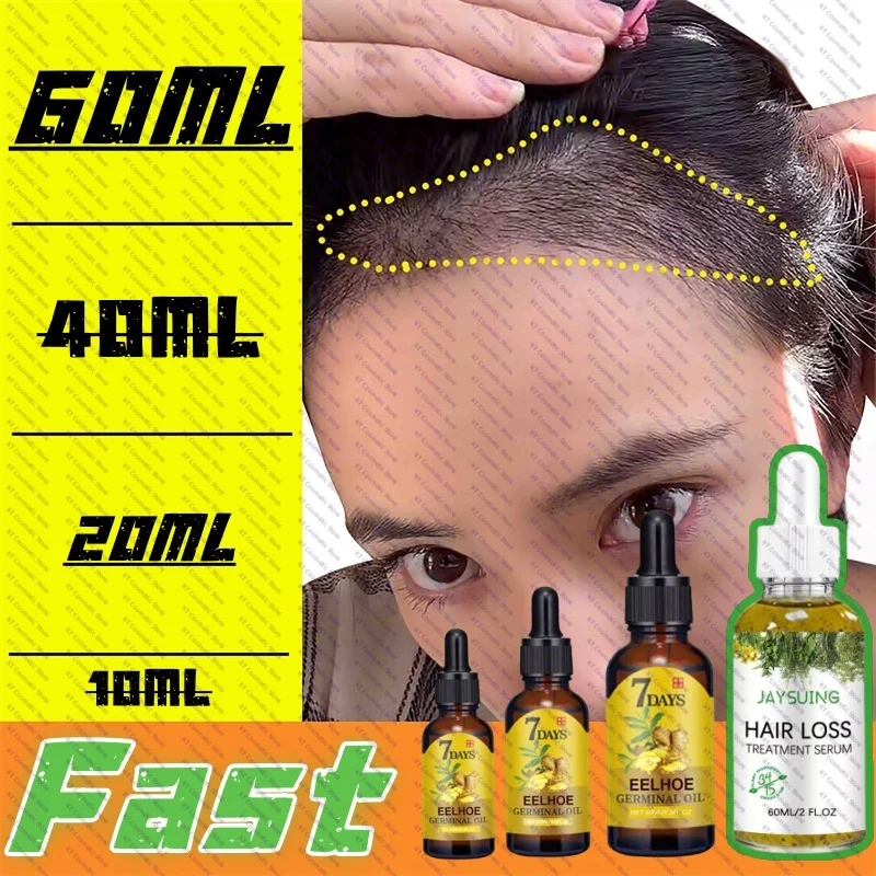 Fast Hair Growth Oil Africa Crazy Traction Alopecia Serum Anti Hair Break Thicken Hair Loss Treatment Spray For Man Women New
Fast Hair Growth Oil Africa Crazy Traction Alopecia Serum Anti Hair Break Thicken Hair Loss Treatment Spray For Man Women New
