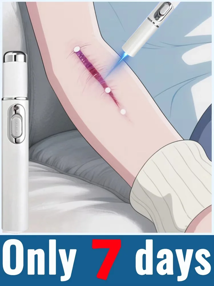 Портативная лазерная ручка Unisx 2025 с синим светом. Новейшая технология удаления шрамов, инструменты для удаления шрамов.
Портативная лазерная ручка Unisx 2025 с синим светом. Новейшая технология удаления шрамов, инструменты для удаления шрамов.