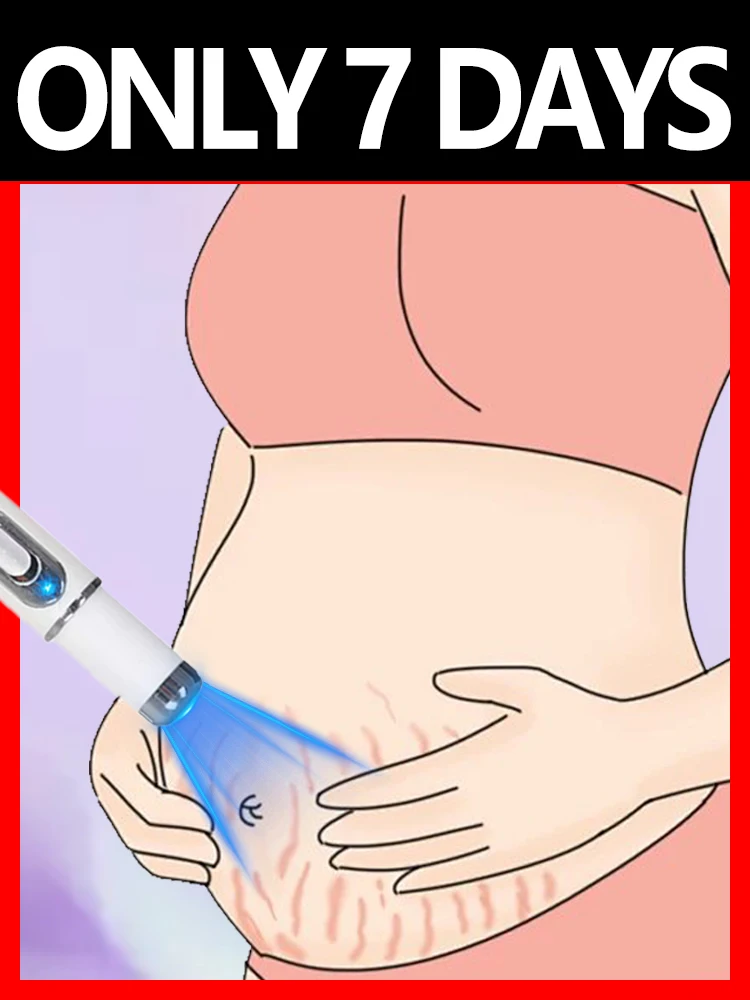 2025 New upgrade Striae blue light tool Goodbye to Stretch Marks, Maternal Skincare Tools 2 in 1 set hot selling
2025 New upgrade Striae blue light tool Goodbye to Stretch Marks, Maternal Skincare Tools 2 in 1 set hot selling