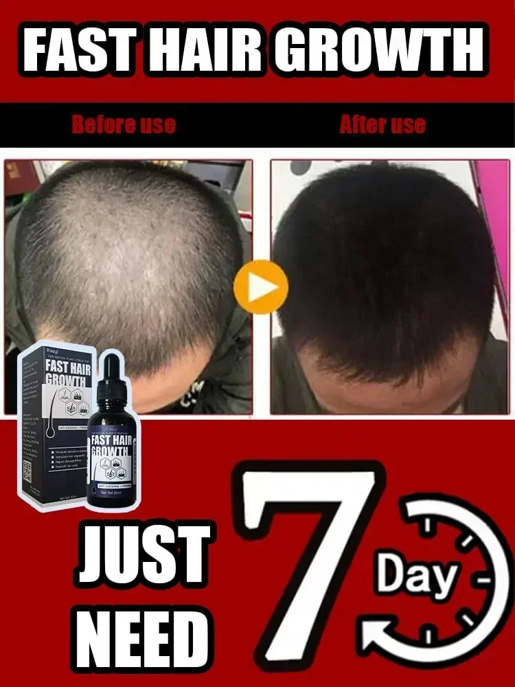 Rapid hair growth | Stimulate Growth for Hair | Visibly Thicker and Stronger Hair
Rapid hair growth | Stimulate Growth for Hair | Visibly Thicker and Stronger Hair