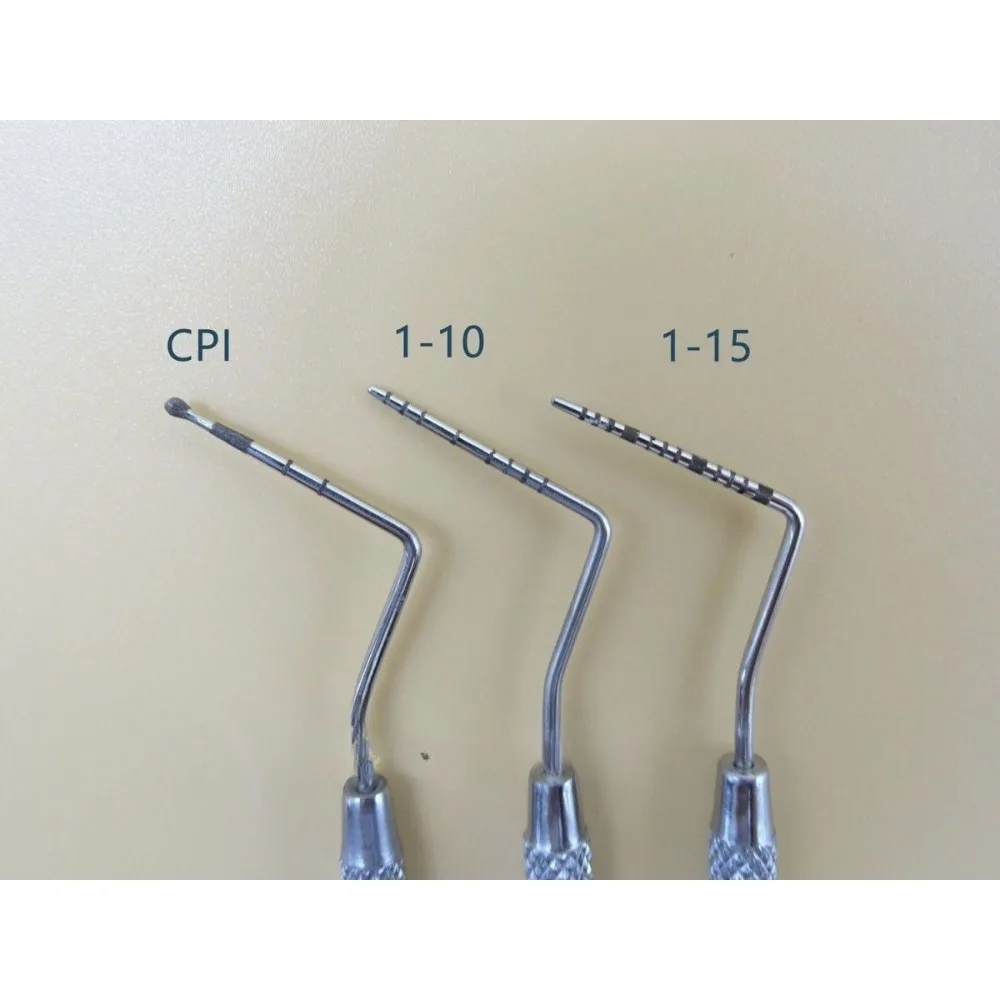 Dental Material Probe Stainless Steel CPI Probe Periodontal Scale Probe Head Ball Exam Tool Dental Instrument Repair Scale Tools
Dental Material Probe Stainless Steel CPI Probe Periodontal Scale Probe Head Ball Exam Tool Dental Instrument Repair Scale Tools