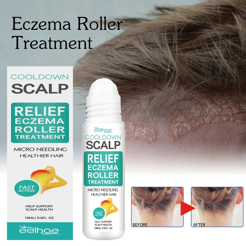 Scalp Care Roller Ball - Nourishing Treatment For Dry Scalp, Helps Strengthen Hair Roots & Support Healthy Hair Growth
Scalp Care Roller Ball - Nourishing Treatment For Dry Scalp, Helps Strengthen Hair Roots & Support Healthy Hair Growth