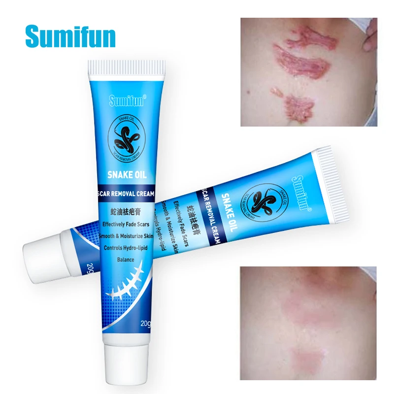 Sumifun 20g Scar Removal Cream Remove Acne Spots Treatment Stretch Marks Burn Surgical Cream Skin Scar Repair Smoothing Ointment
Sumifun 20g Scar Removal Cream Remove Acne Spots Treatment Stretch Marks Burn Surgical Cream Skin Scar Repair Smoothing Ointment