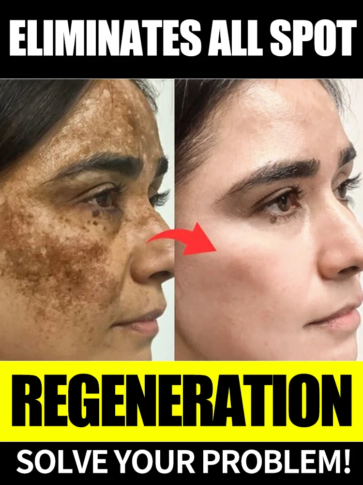 Effectively lightens dark spots and restores facial skin
Effectively lightens dark spots and restores facial skin