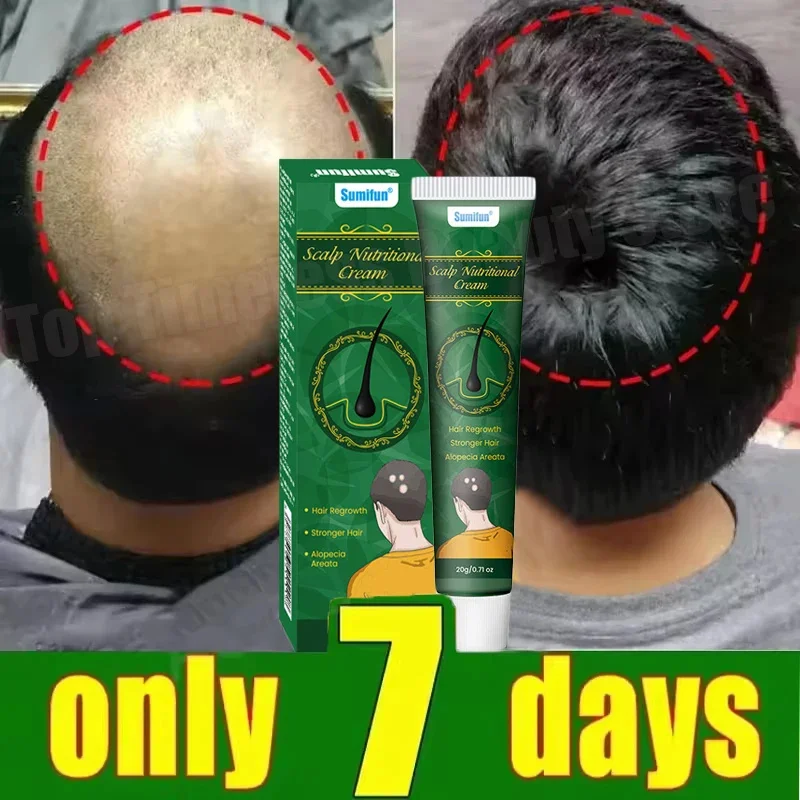 Hair Growth Cream 7 Days Fast Regrowth Essential Capsule Anti Hair loss Baldness Repair Damaged Scalp Treatment For Women Men
Hair Growth Cream 7 Days Fast Regrowth Essential Capsule Anti Hair loss Baldness Repair Damaged Scalp Treatment For Women Men