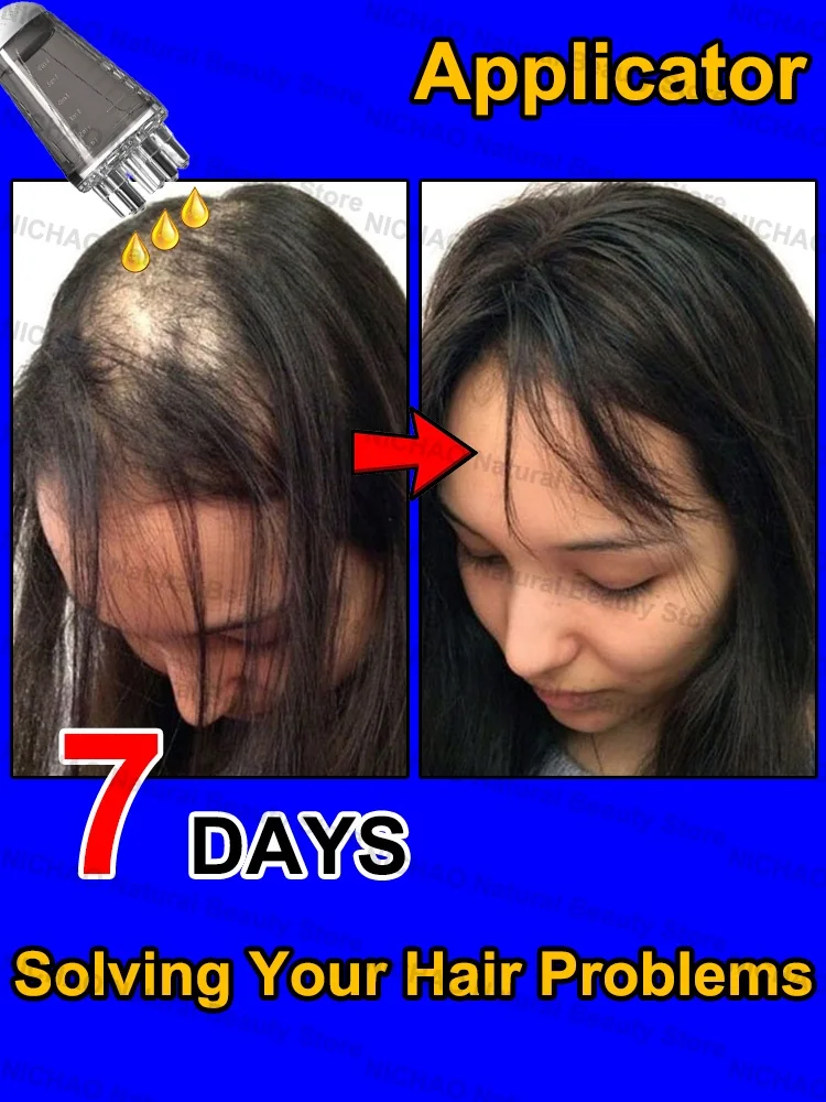 7 Days Fast Hair Growth Essential Loss Regrowth Treatment Strengthens Hair Nourishes Scalp Light Weight Non Greasy
7 Days Fast Hair Growth Essential Loss Regrowth Treatment Strengthens Hair Nourishes Scalp Light Weight Non Greasy
