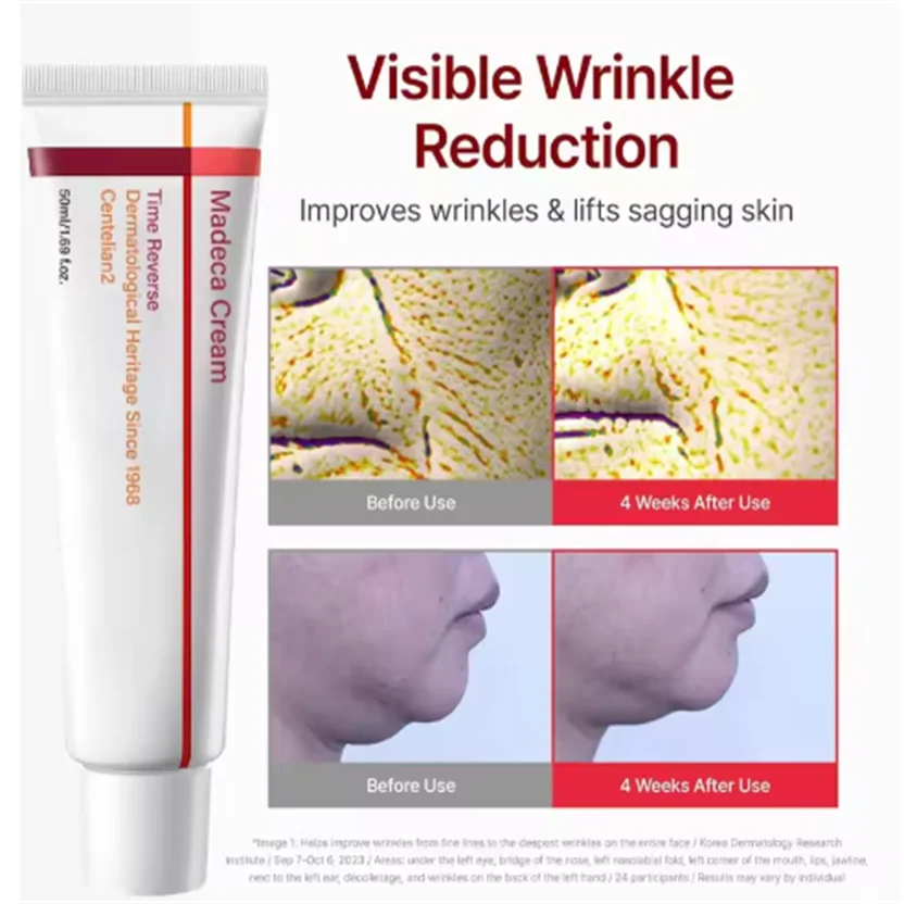 Мягкий ниацинамидный осветляющий крем с мелазмой, эффективно выцветает, отбеливающий крем с меланином, удаление темного пигмента, увлажняющий уход за кожей
Мягкий ниацинамидный осветляющий крем с мелазмой, эффективно выцветает, отбеливающий крем с меланином, удаление темного пигмента, увлажняющий уход за кожей