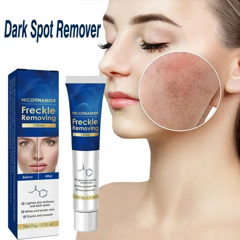 Dark Spot Remover for Face Removing Freckle Chloasma Senile Plaques Sunburn Cyasma Chorioplaque Freckle Cream
Dark Spot Remover for Face Removing Freckle Chloasma Senile Plaques Sunburn Cyasma Chorioplaque Freckle Cream