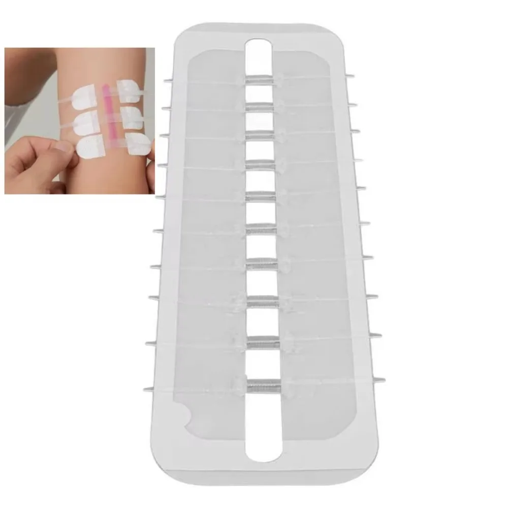 Zipper Tie Band Aid Adhesive Wound Closure Band Aid Wound Closure Bandaid Emergency Kit Bandage Fast Suture Hemostatic Patch New
Zipper Tie Band Aid Adhesive Wound Closure Band Aid Wound Closure Bandaid Emergency Kit Bandage Fast Suture Hemostatic Patch New