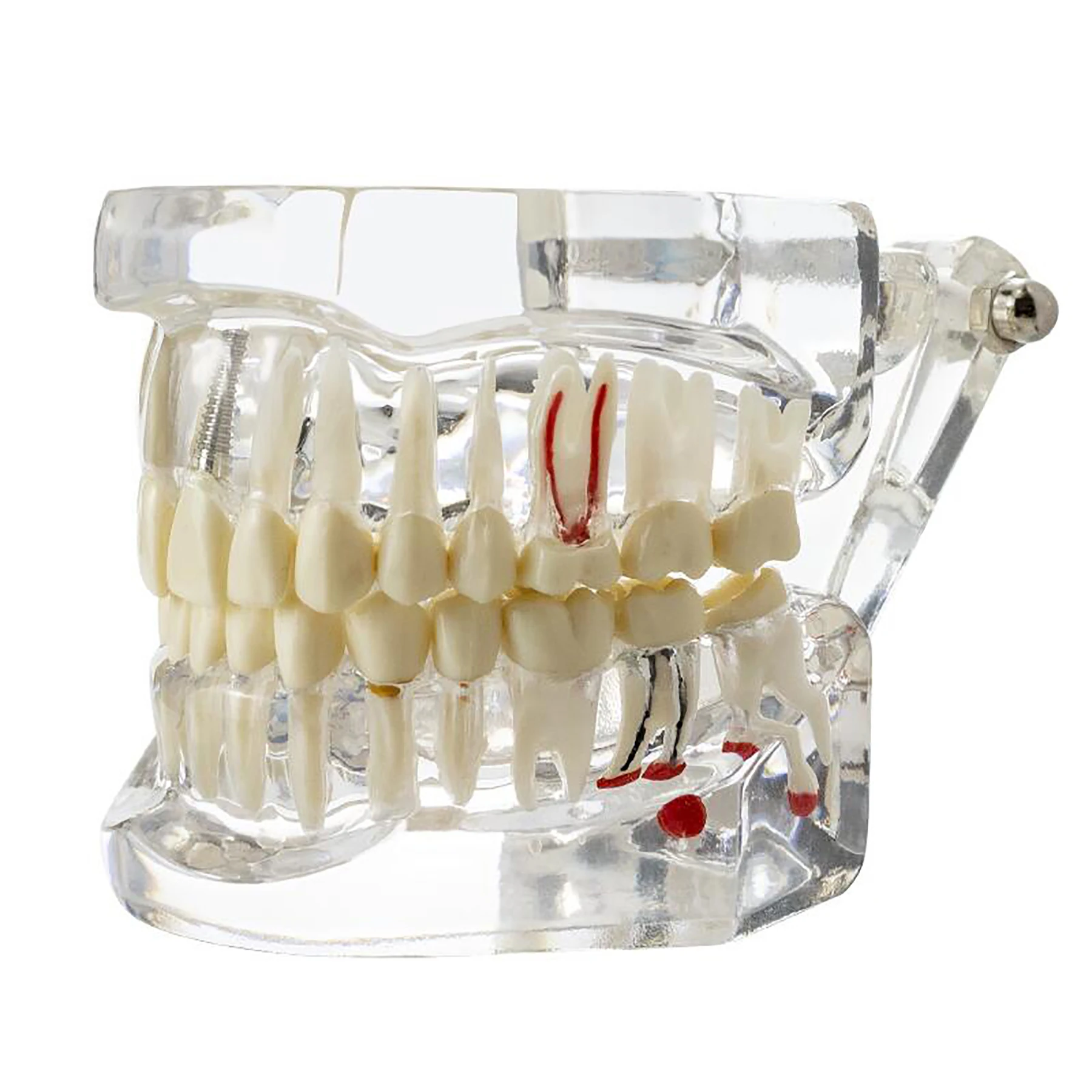 Dental laboratory Implant Disease Repairable Resin Models Dentist Dental Student Learning Teaching Research Communication
Dental laboratory Implant Disease Repairable Resin Models Dentist Dental Student Learning Teaching Research Communication