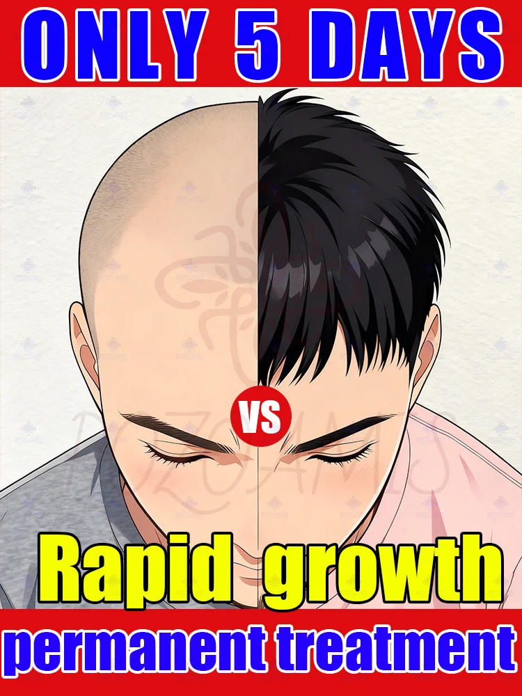 Top looking sparse Try this "little bottle"
Top looking sparse Try this "little bottle"