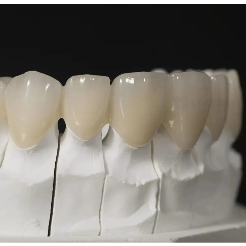 3D MULTI-LAYER предварительно тенированный циркониевый пустой суперпрозрачный стоматологический циркониевый блок для фрезерной системы Cad-Cam B1
3D MULTI-LAYER предварительно тенированный циркониевый пустой суперпрозрачный стоматологический циркониевый блок для фрезерной системы Cad-Cam B1