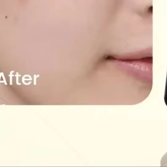 Ice Blue Microcurrent Small Bubble Facial Machine For Skin Cleansing Exfoliation Hydration And Skin Brightening
Ice Blue Microcurrent Small Bubble Facial Machine For Skin Cleansing Exfoliation Hydration And Skin Brightening