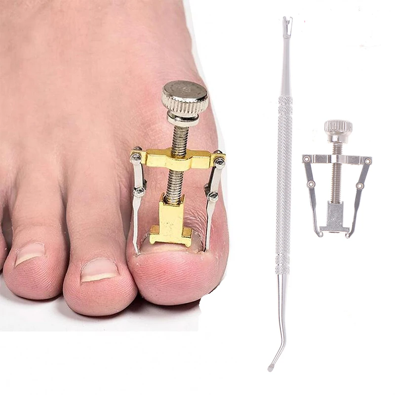 Ingrown Corrector Toenail Fixer Stainless Steel Nail Straighten Clip Paronychia Cure Relief Pain Pedicure Tools Health Care 
Ingrown Corrector Toenail Fixer Stainless Steel Nail Straighten Clip Paronychia Cure Relief Pain Pedicure Tools Health Care