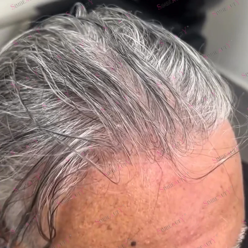 Undetectable Micro Thin Skin Natural Hairline 100% Human Hair Men Toupee Full 0.02-0.03mm Skin Base 80Density Comfortable Wigs
Undetectable Micro Thin Skin Natural Hairline 100% Human Hair Men Toupee Full 0.02-0.03mm Skin Base 80Density Comfortable Wigs