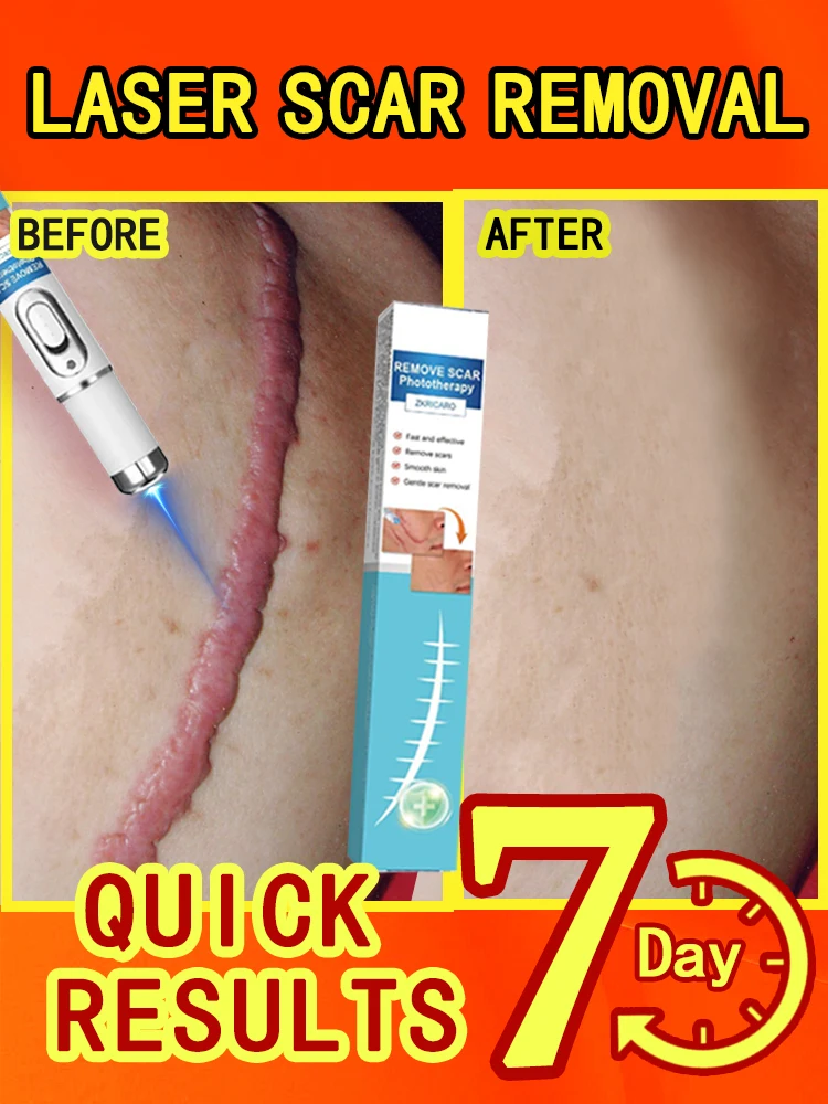 remove scars in 7 days
remove scars in 7 days