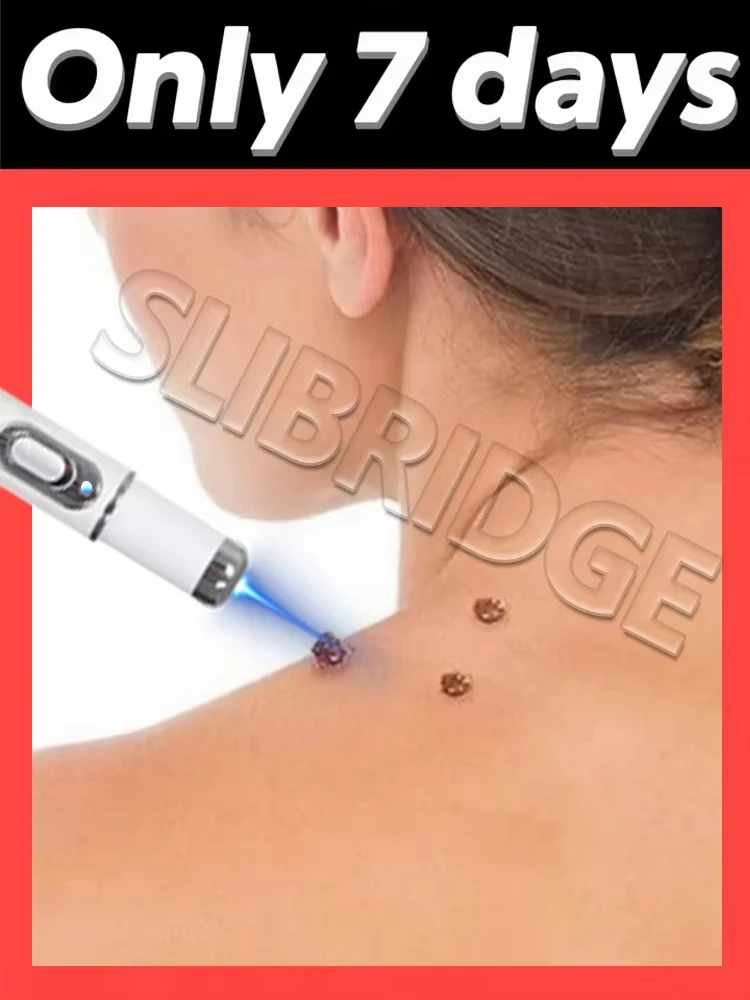 The latest generation of blue light wart removal pen quickly eliminates warts.
The latest generation of blue light wart removal pen quickly eliminates warts.
