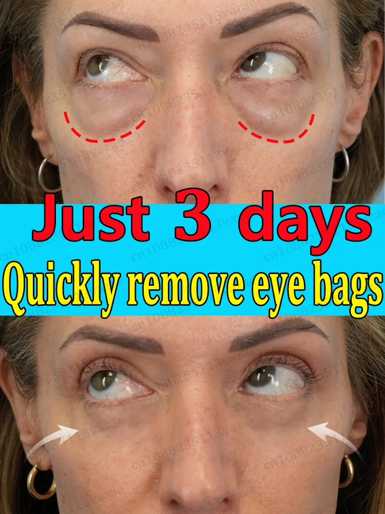 Sᴀʏ ɢᴏᴏᴅʙʏᴇ ᴛᴏ ᴇʏᴇ ʙᴀɢs, ᴡʀɪɴᴋʟᴇs ᴀɴᴅ ᴅᴀʀᴋ ᴄɪʀᴄʟᴇs, sᴛᴀʏ ʏᴏᴜᴛʜғᴜʟ ғᴏʀᴇᴠᴇʀ 
Sᴀʏ ɢᴏᴏᴅʙʏᴇ ᴛᴏ ᴇʏᴇ ʙᴀɢs, ᴡʀɪɴᴋʟᴇs ᴀɴᴅ ᴅᴀʀᴋ ᴄɪʀᴄʟᴇs, sᴛᴀʏ ʏᴏᴜᴛʜғᴜʟ ғᴏʀᴇᴠᴇʀ