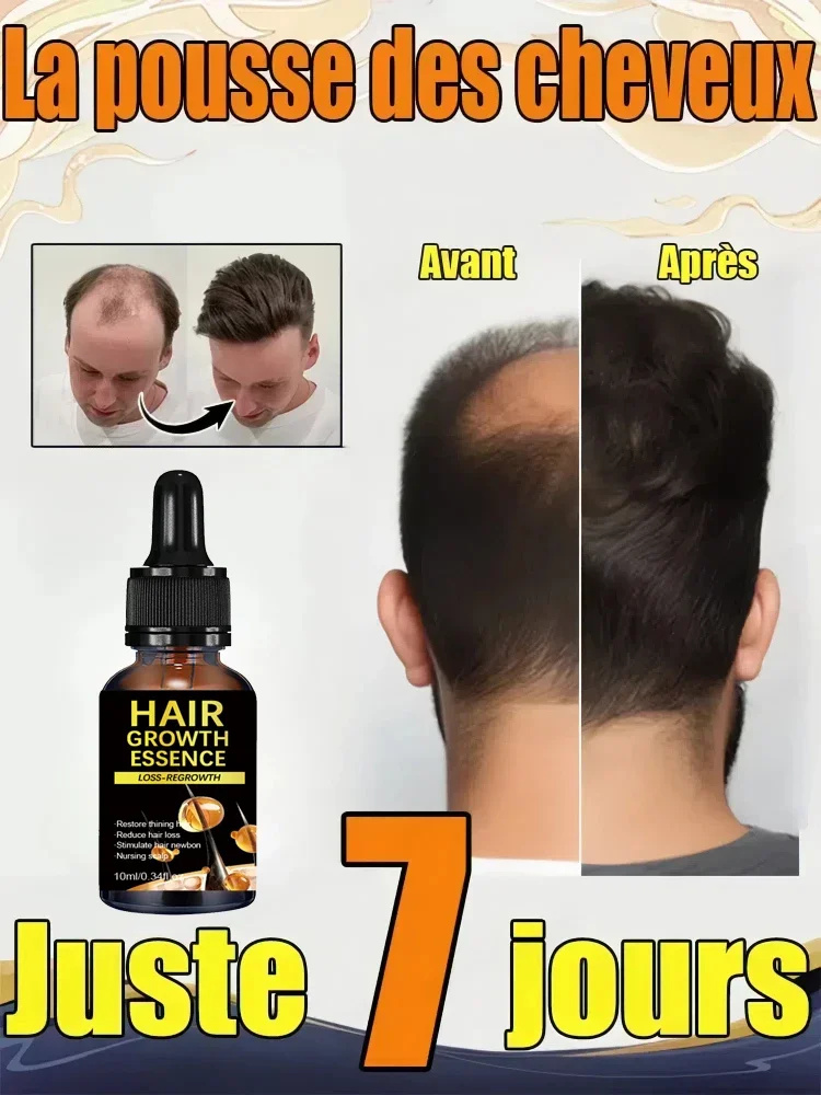 Huile essentielle de croissance rapide des cheveux, répare la calvitie et dit adieu aux problèmes de perte de cheveux.
Huile essentielle de croissance rapide des cheveux, répare la calvitie et dit adieu aux problèmes de perte de cheveux.